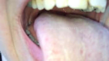 Demonstration of the Mouth (Annie) Video 1